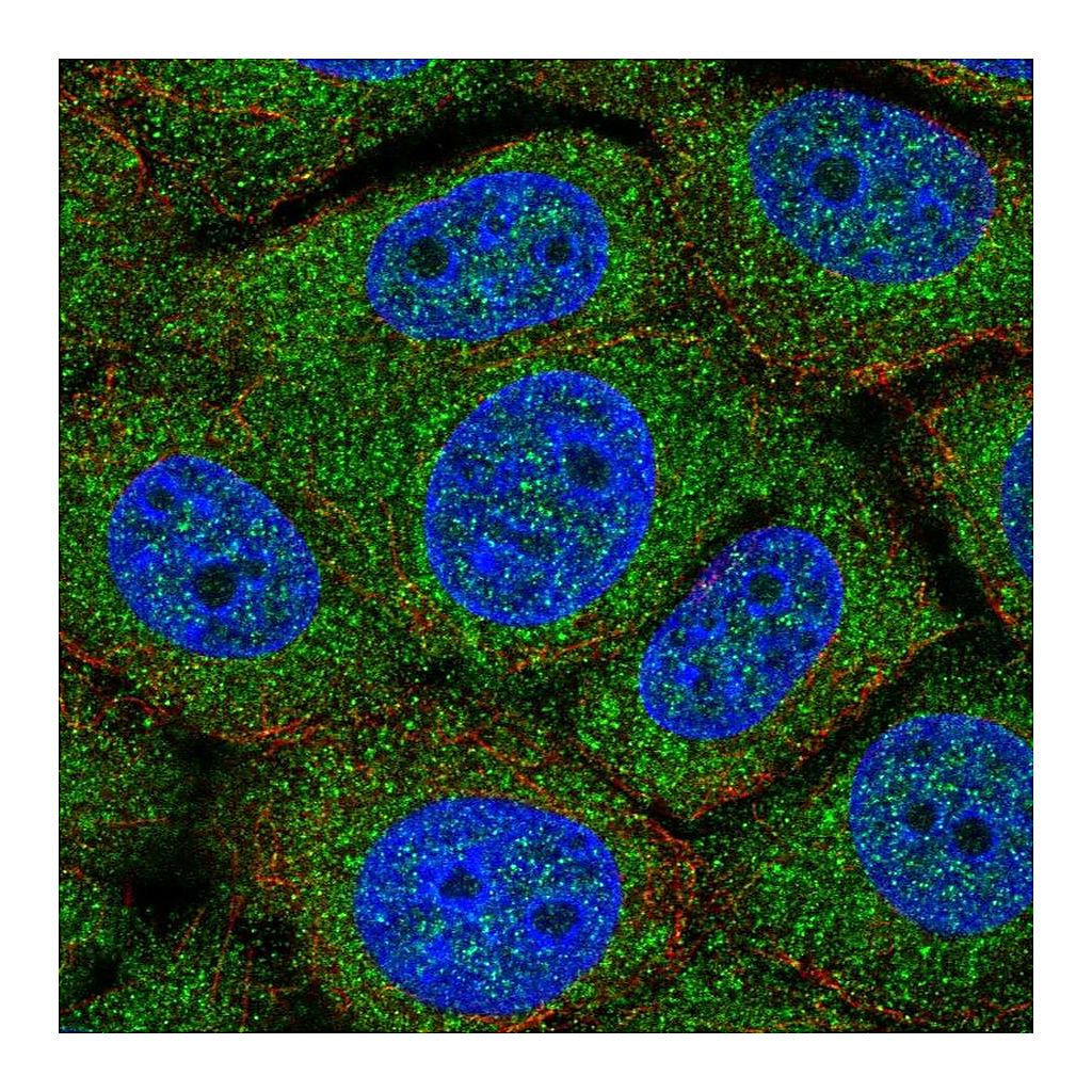 Atlas Antibodies Anti-TMEM254 Antibody