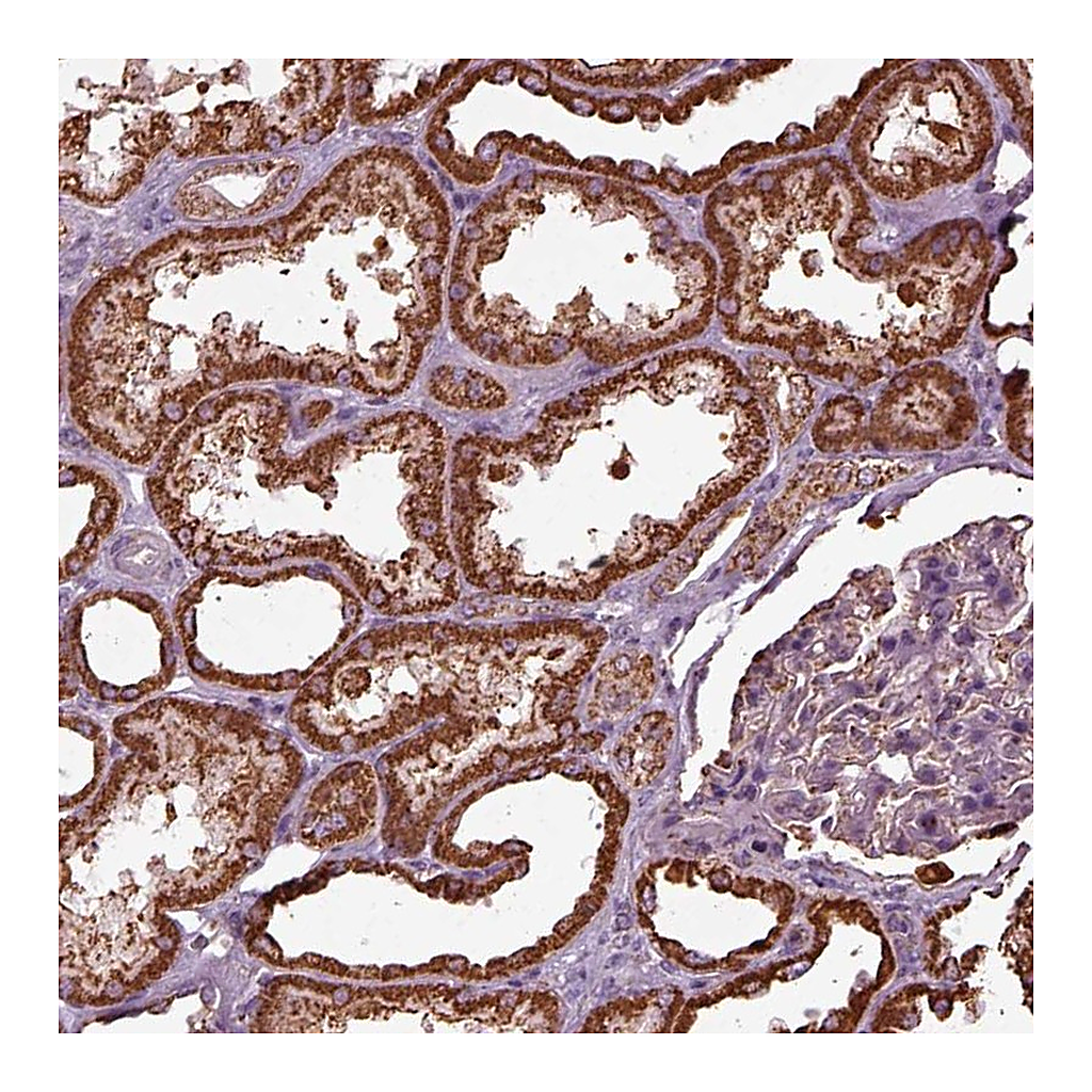Atlas Antibodies Anti-TMEM254 Antibody