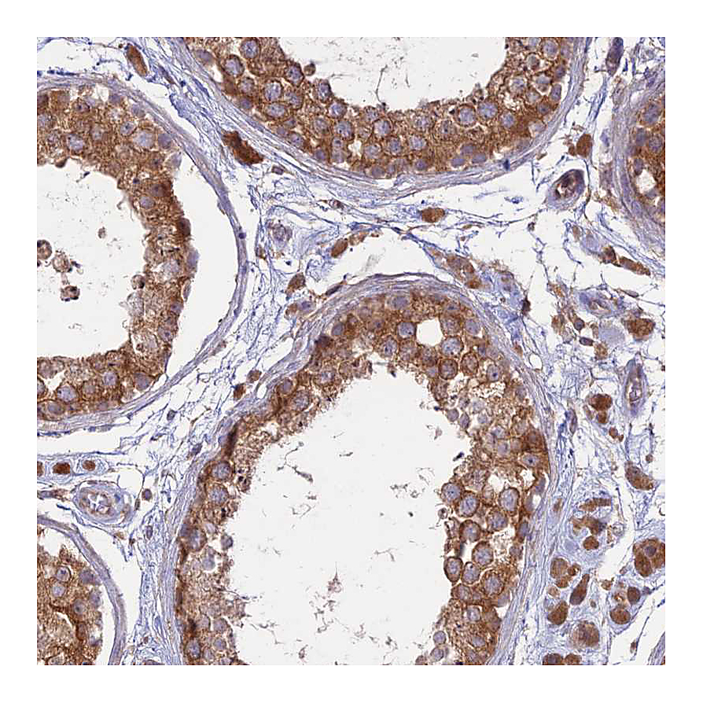 Atlas Antibodies Anti-TMEM259 Antibody