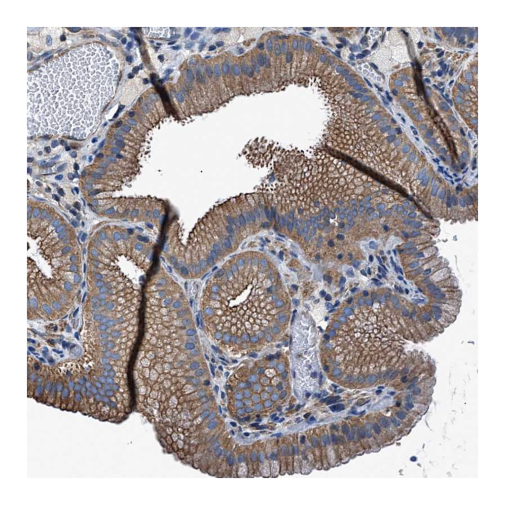 Atlas Antibodies Anti-TMEM261 Antibody