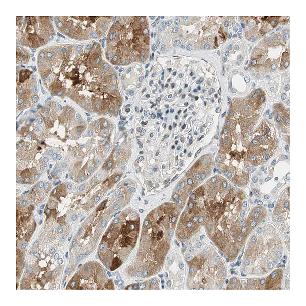 Atlas Antibodies Anti-TMEM260 Antibody