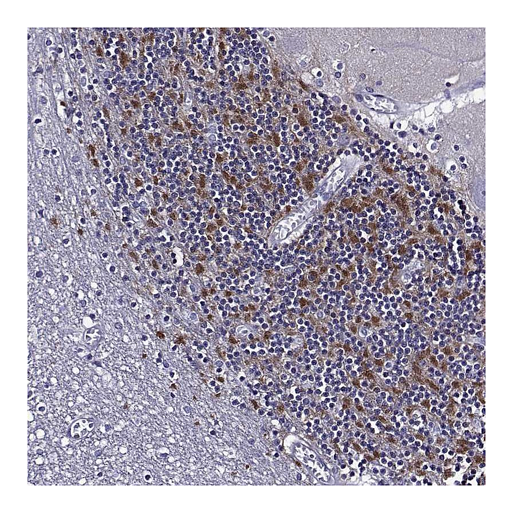 Atlas Antibodies Anti-TMEM266 Antibody