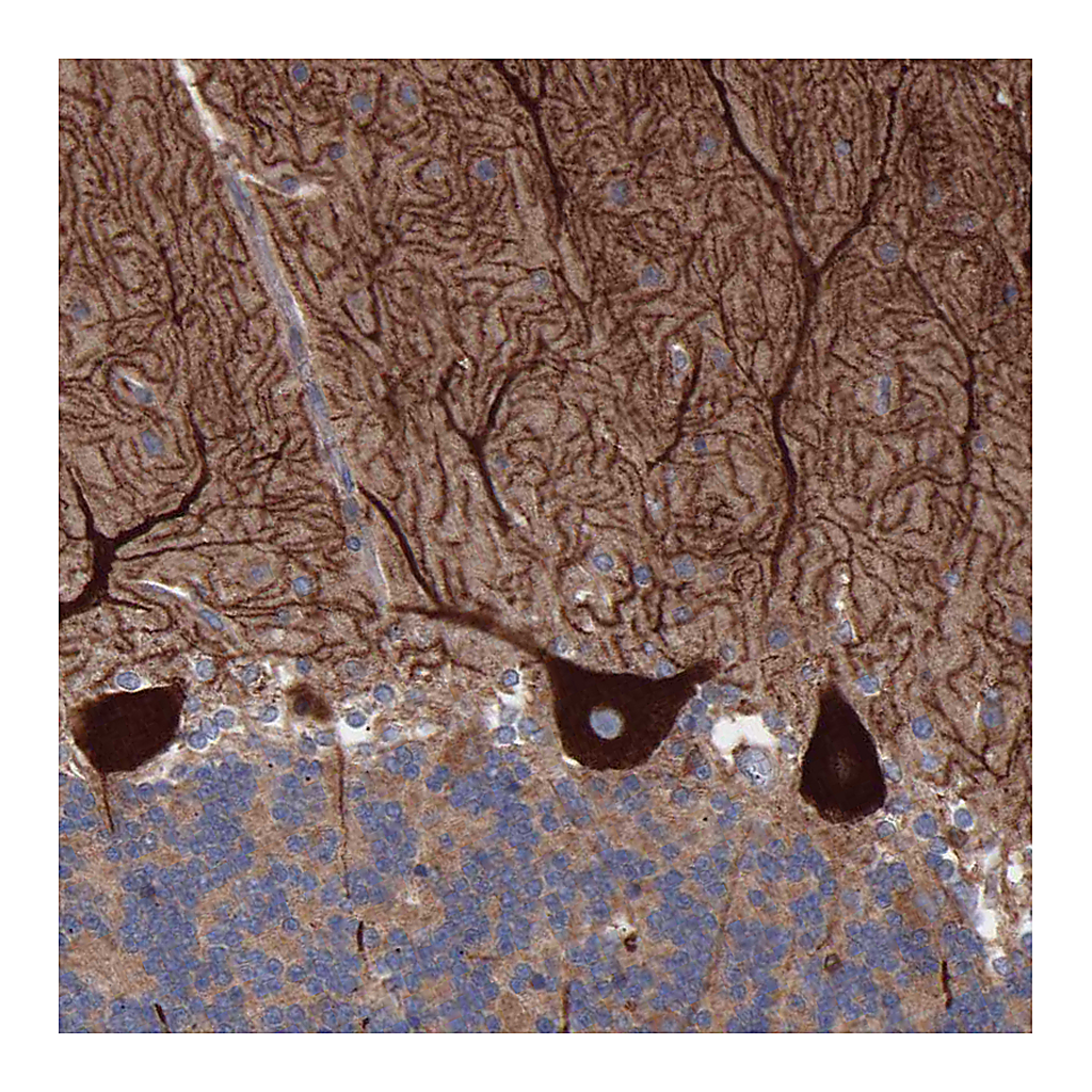 Atlas Antibodies Anti-TMEM268 Antibody