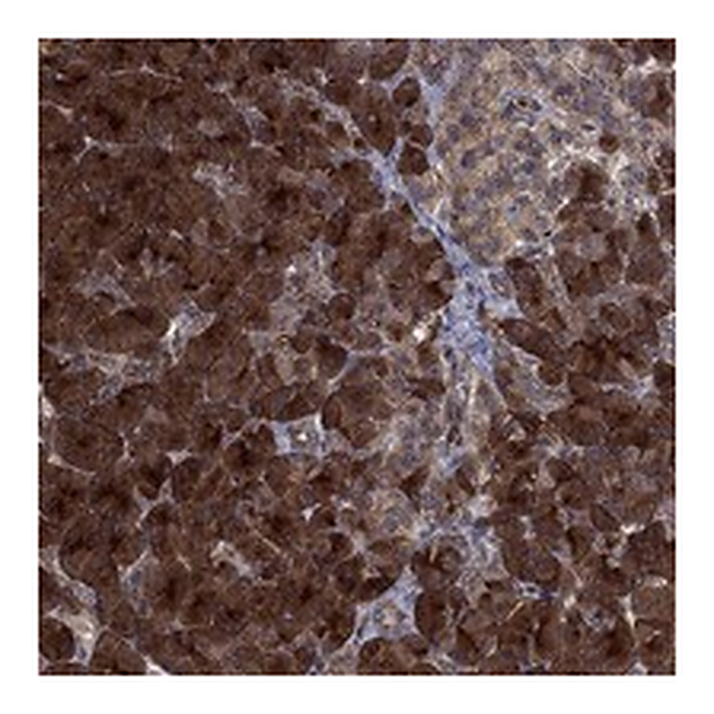 Atlas Antibodies Anti-TMEM33 Antibody