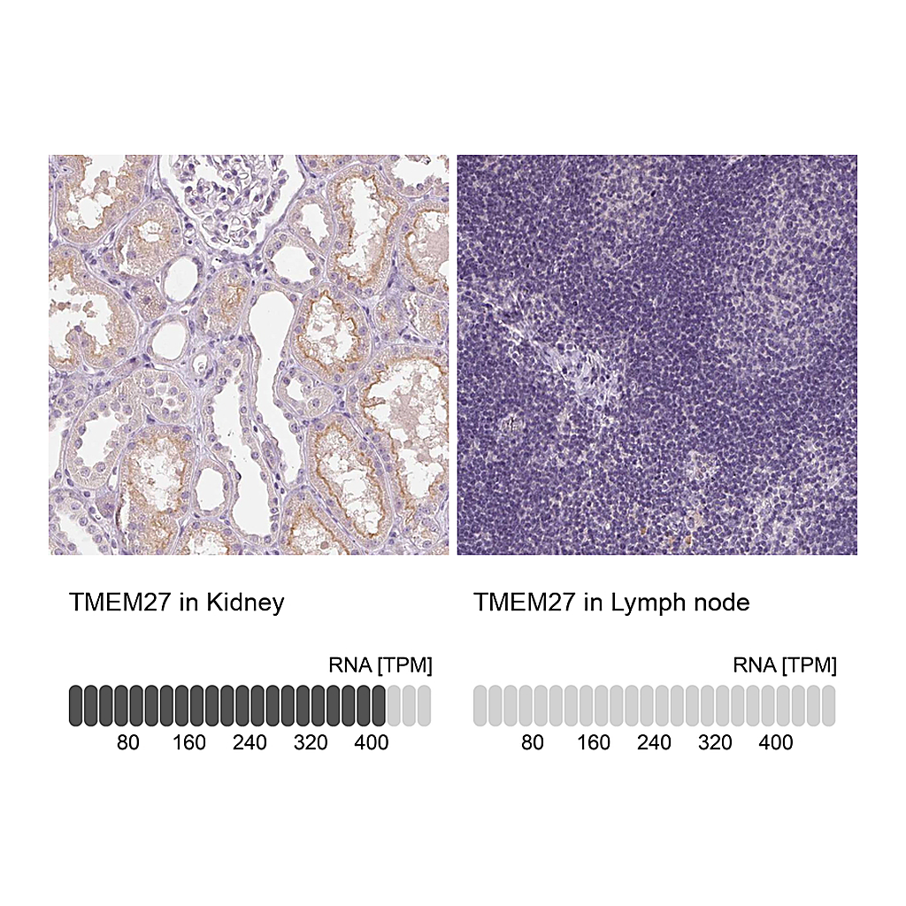 Atlas Antibodies Anti-TMEM27 Antibody