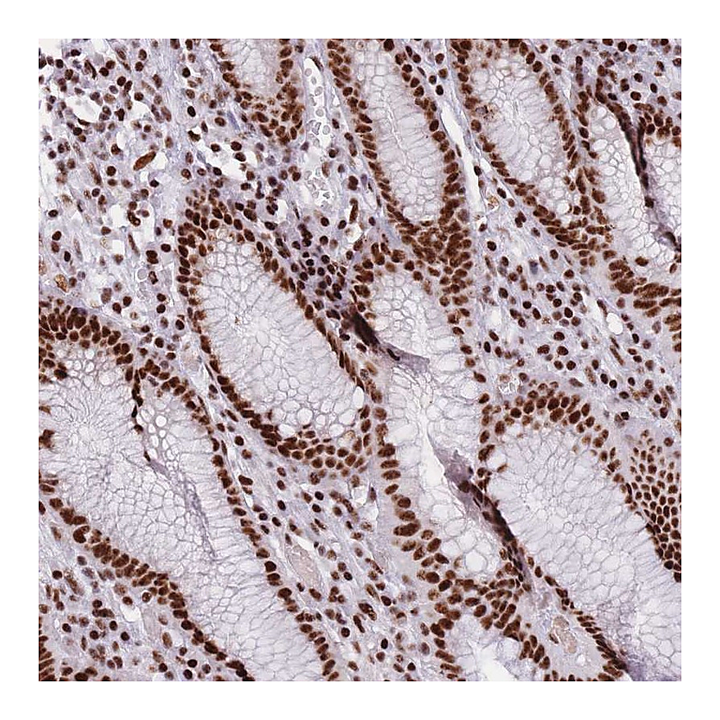 Atlas Antibodies Anti-TMEM35B Antibody