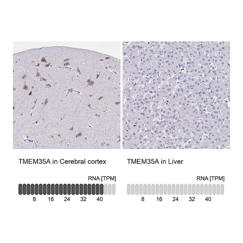 Atlas Antibodies Anti-TMEM35A Antibody