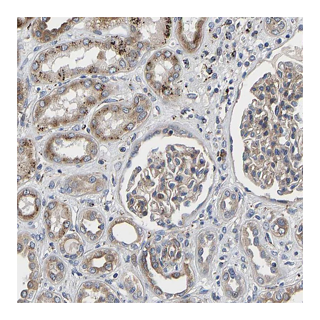 Atlas Antibodies Anti-TMEM38B Antibody