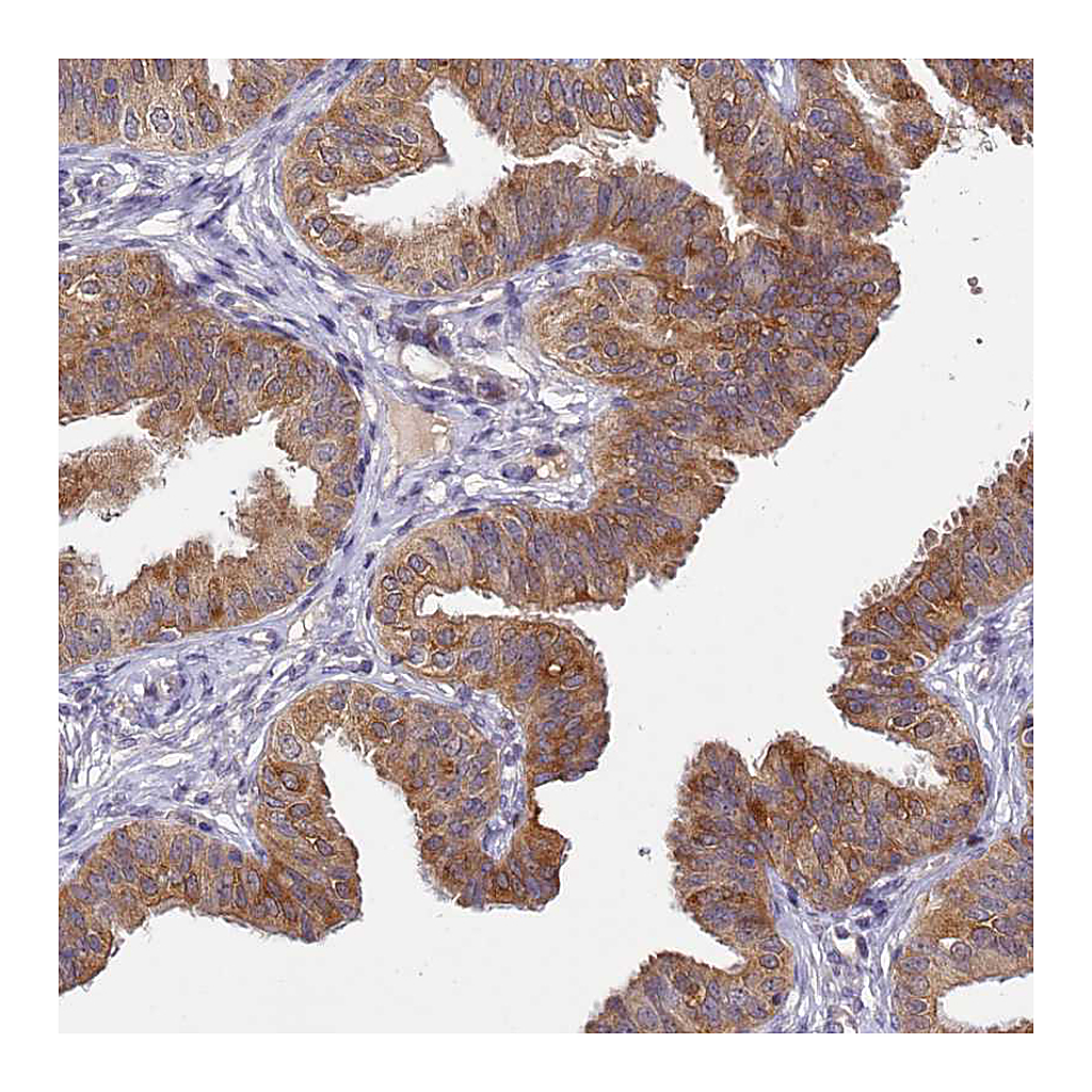 Atlas Antibodies Anti-TMEM39A Antibody
