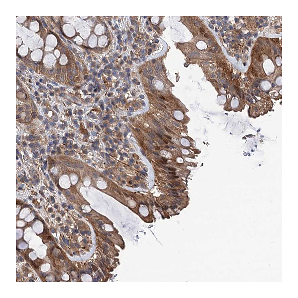 Atlas Antibodies Anti-TMEM39B Antibody