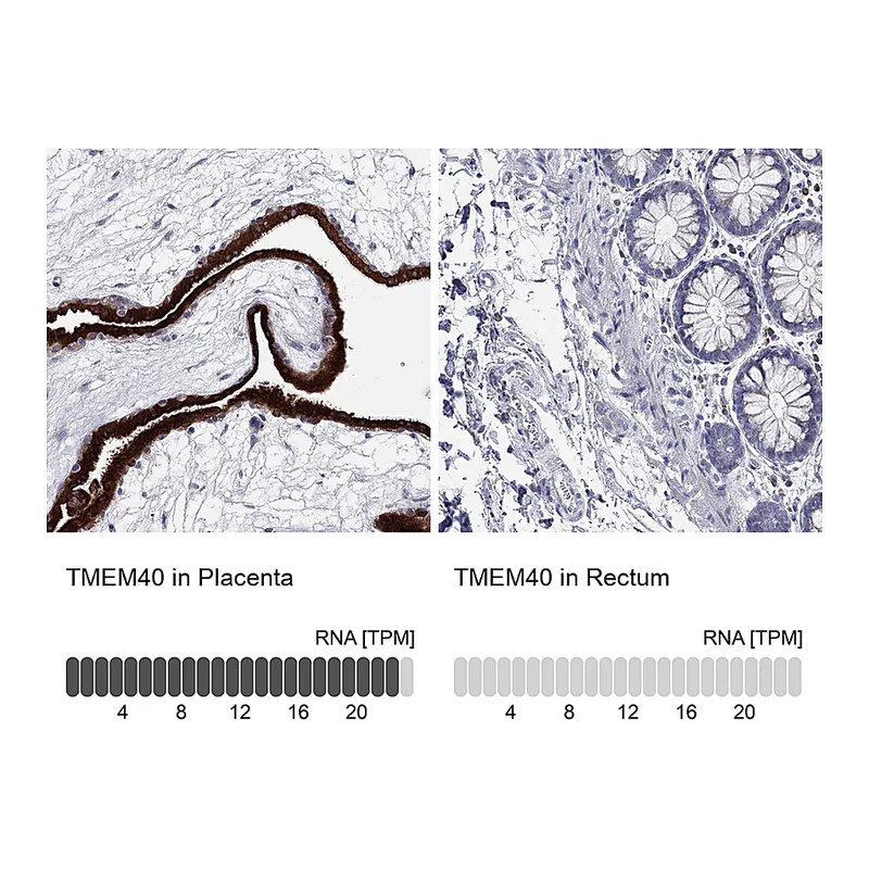 Atlas Antibodies Anti-TMEM40 Antibody