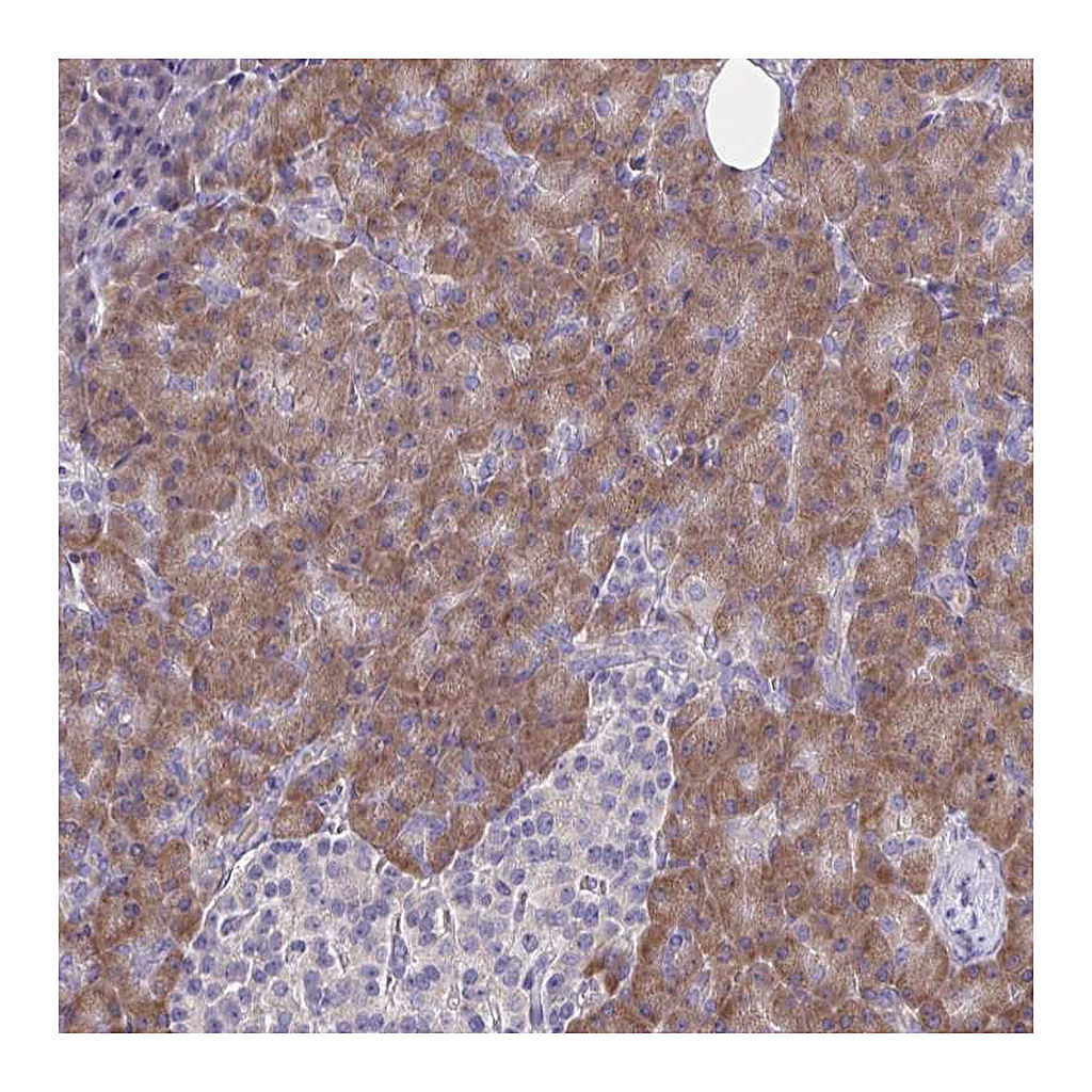 Atlas Antibodies Anti-TMEM41A Antibody