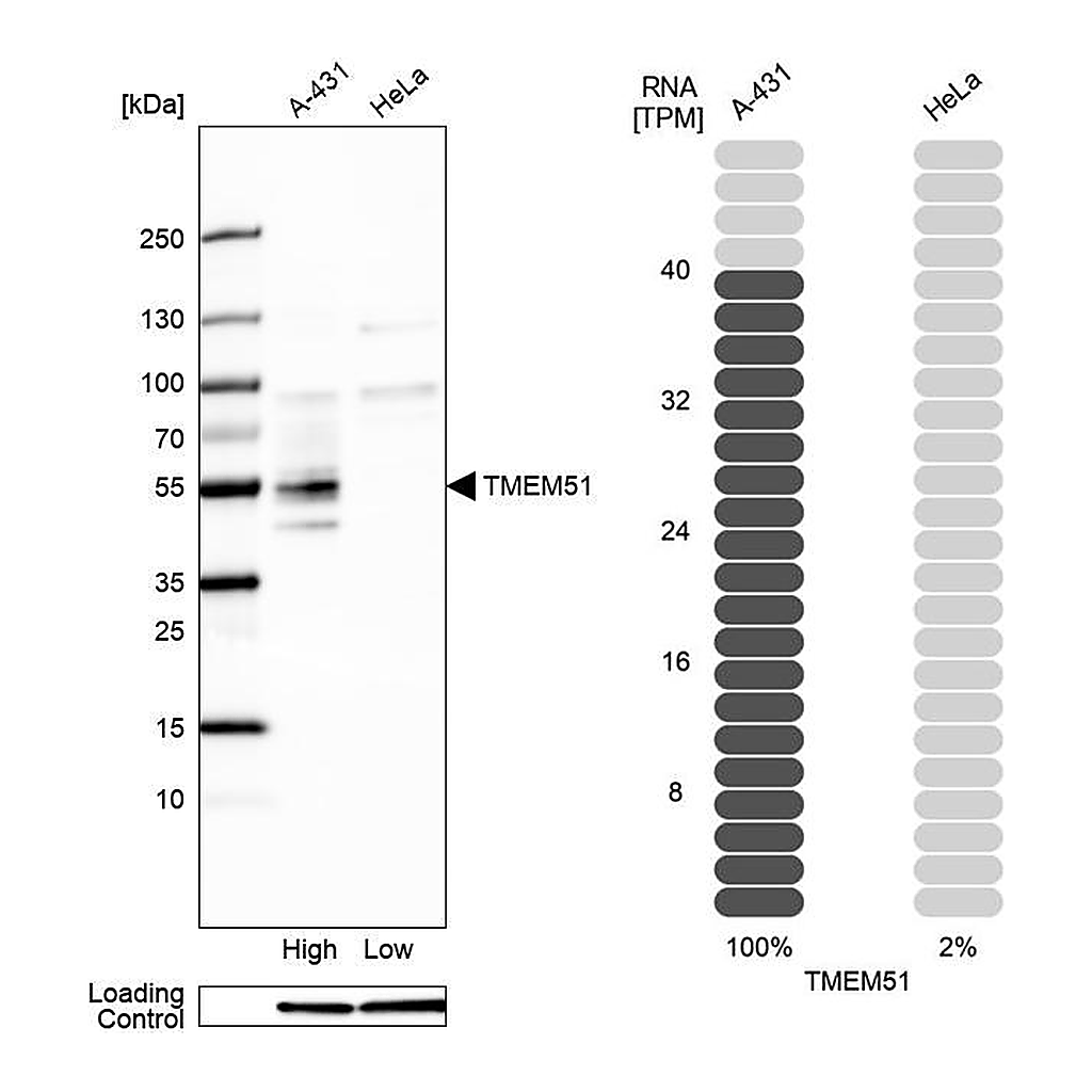Atlas Antibodies Anti-TMEM51 Antibody