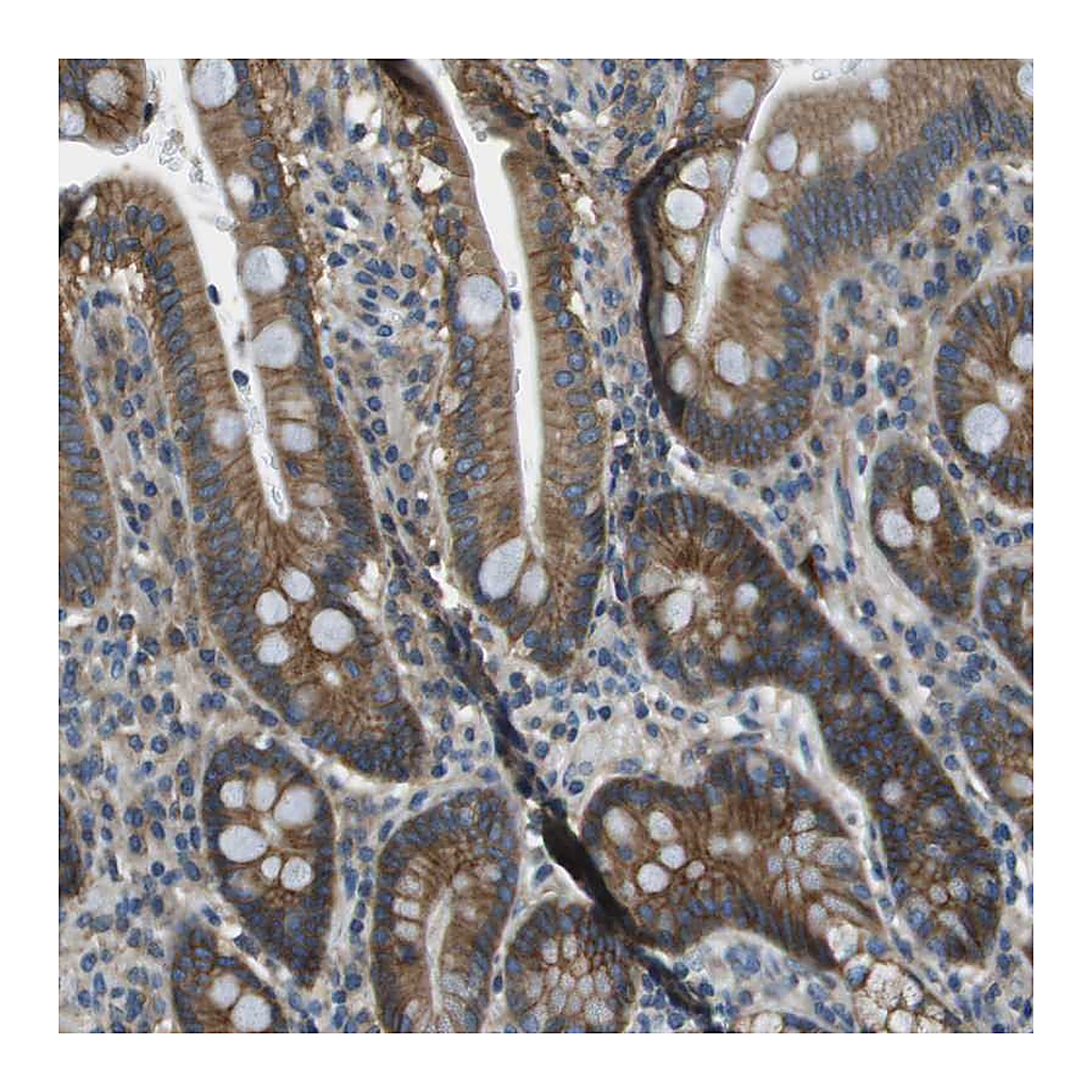 Atlas Antibodies Anti-TMEM51 Antibody