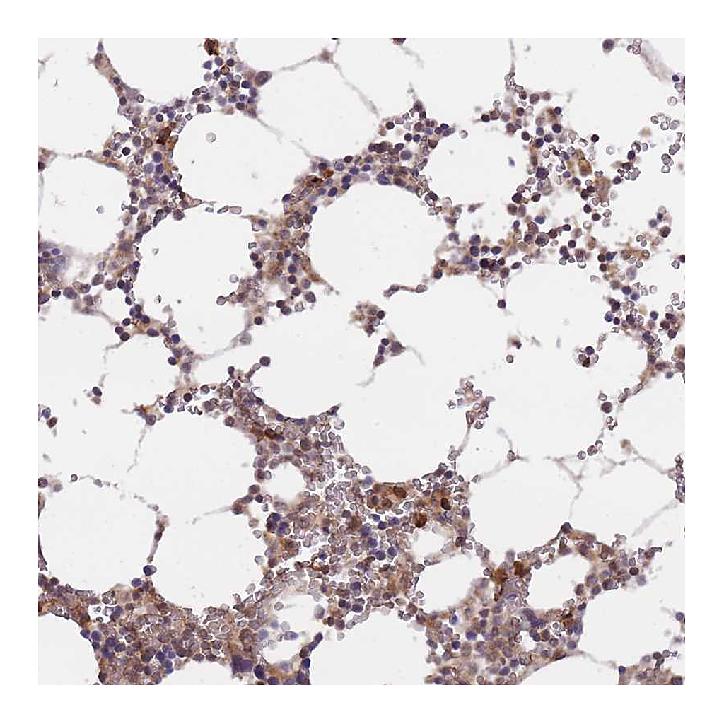 Atlas Antibodies Anti-TMEM55B Antibody