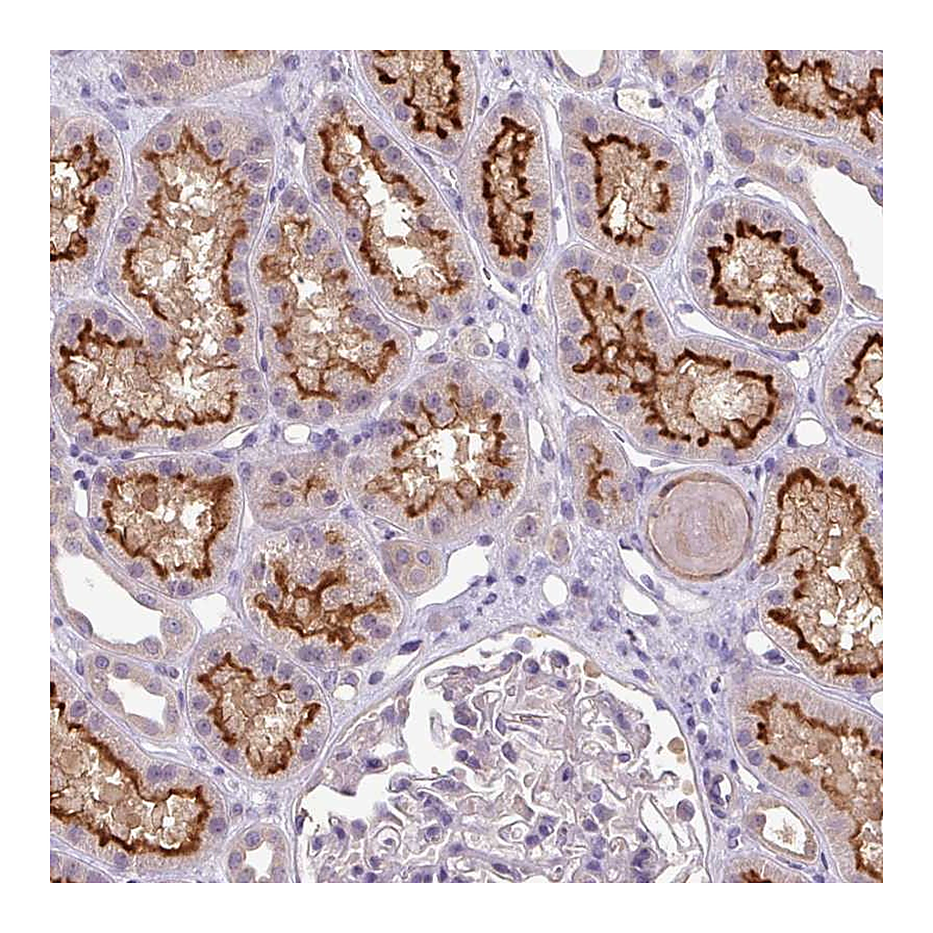 Atlas Antibodies Anti-TMEM62 Antibody