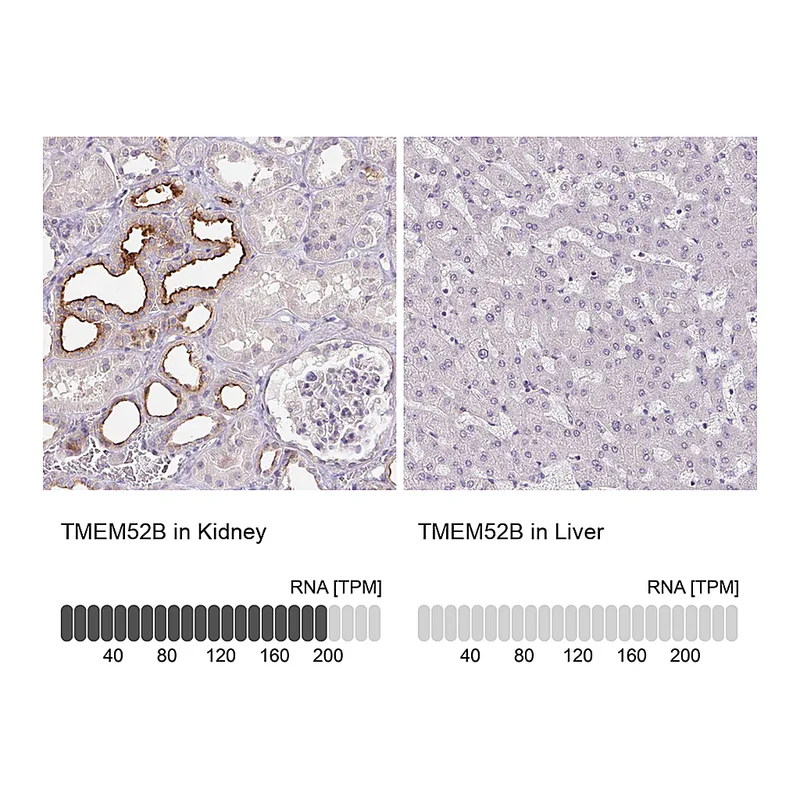 Atlas Antibodies Anti-TMEM52B Antibody