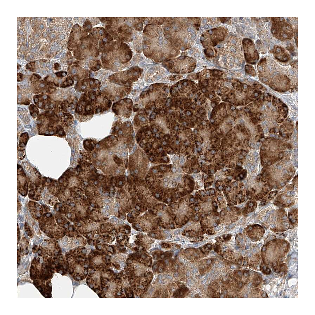 Atlas Antibodies Anti-TMEM61 Antibody
