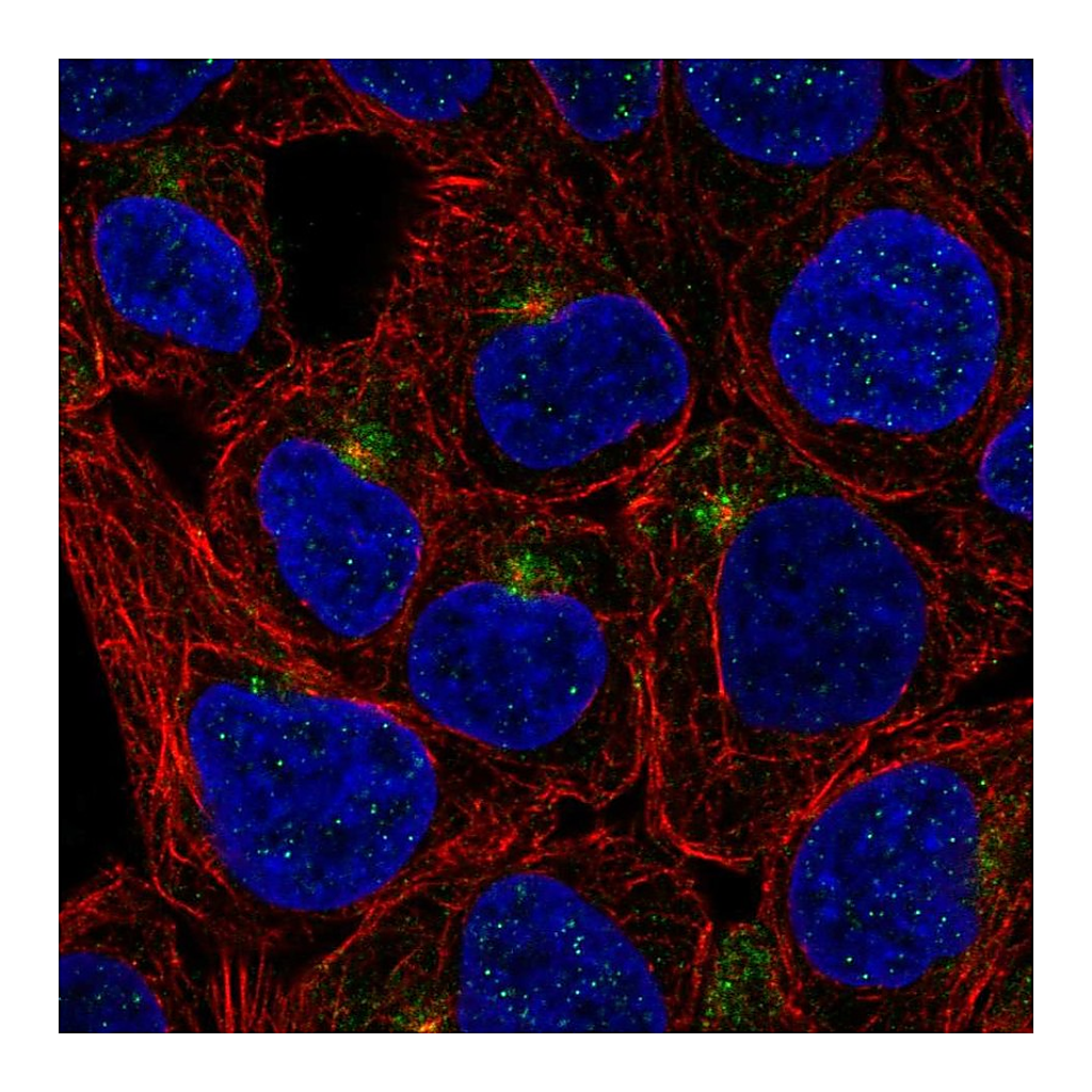 Atlas Antibodies Anti-TMEM63A Antibody