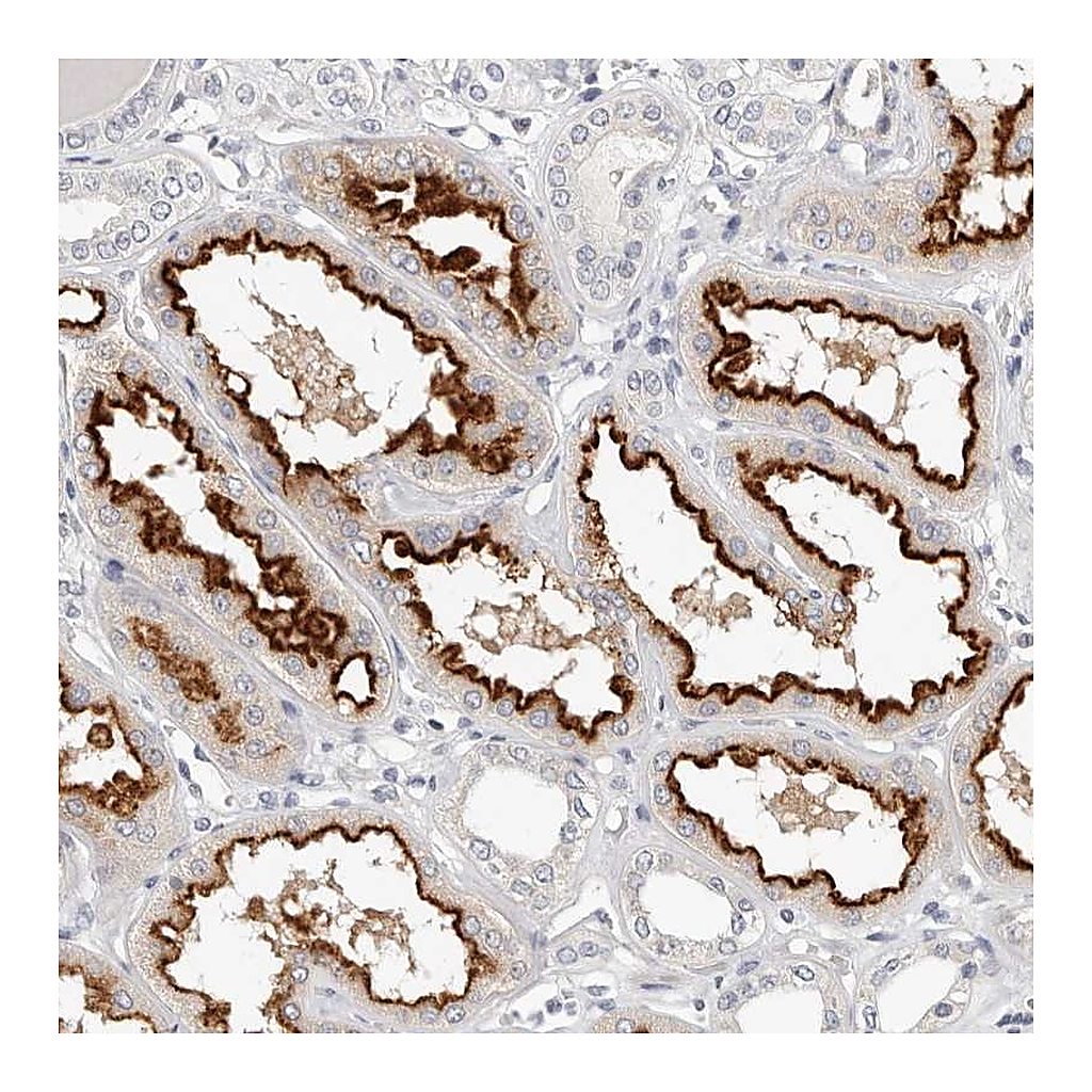 Atlas Antibodies Anti-TMEM63B Antibody