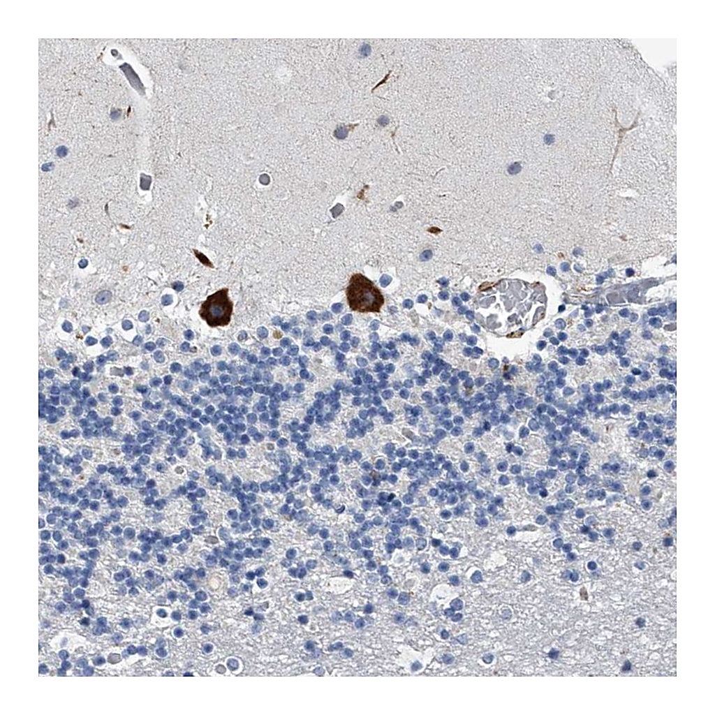 Atlas Antibodies Anti-TMEM63C Antibody