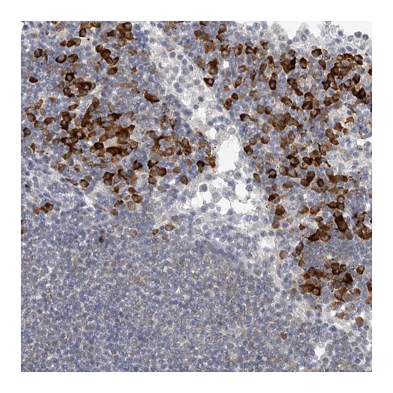 Atlas Antibodies Anti-TMEM69 Antibody