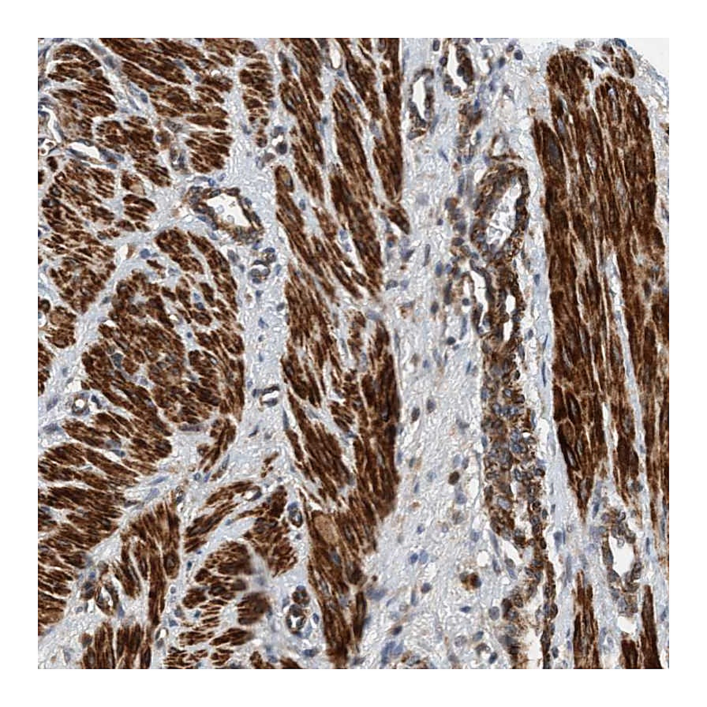 Atlas Antibodies Anti-TMEM70 Antibody