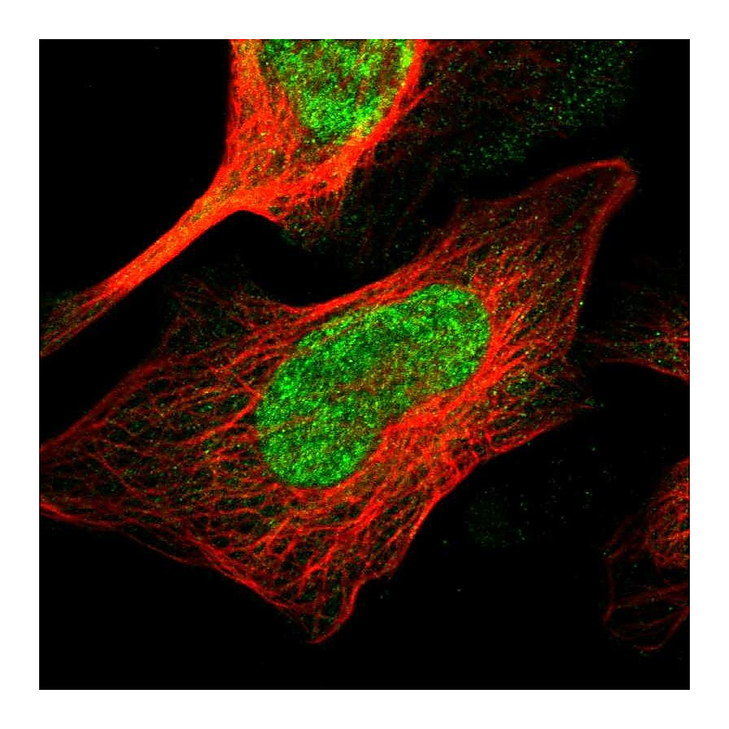 Atlas Antibodies Anti-TMEM65 Antibody