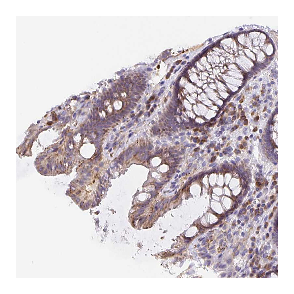 Atlas Antibodies Anti-TMEM71 Antibody