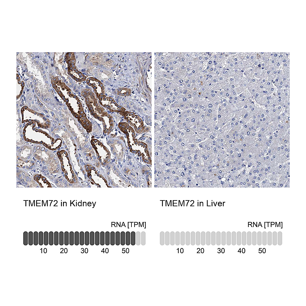 Atlas Antibodies Anti-TMEM72 Antibody