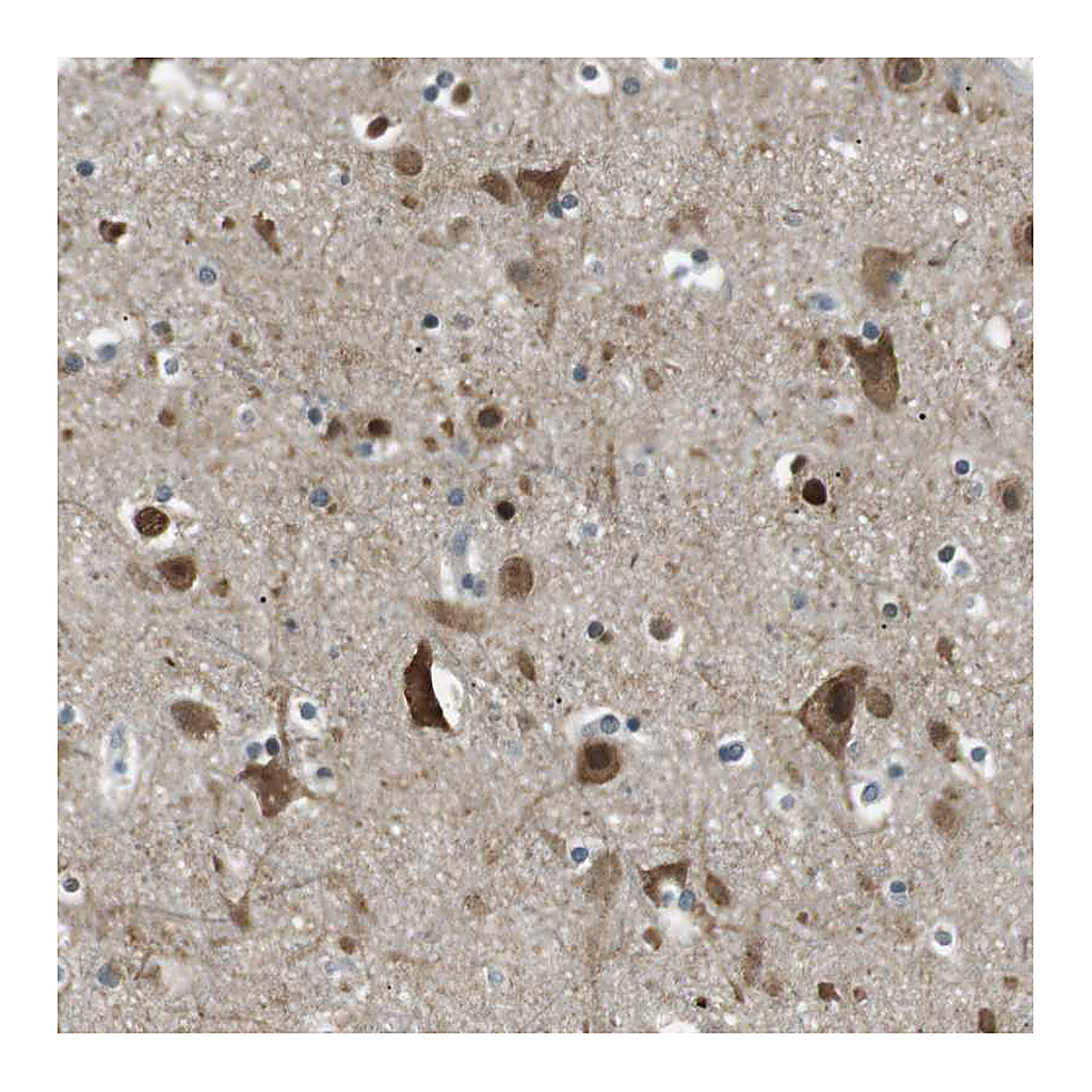Atlas Antibodies Anti-TMEM74 Antibody