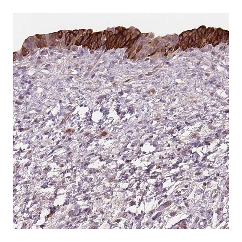 Atlas Antibodies Anti-TMEM80 Antibody