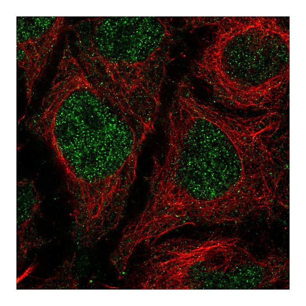 Atlas Antibodies Anti-TMEM8A Antibody