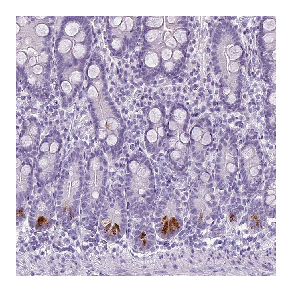 Atlas Antibodies Anti-TMEM91 Antibody