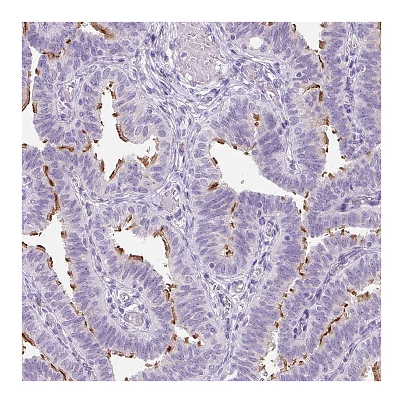 Atlas Antibodies Anti-TMEM89 Antibody
