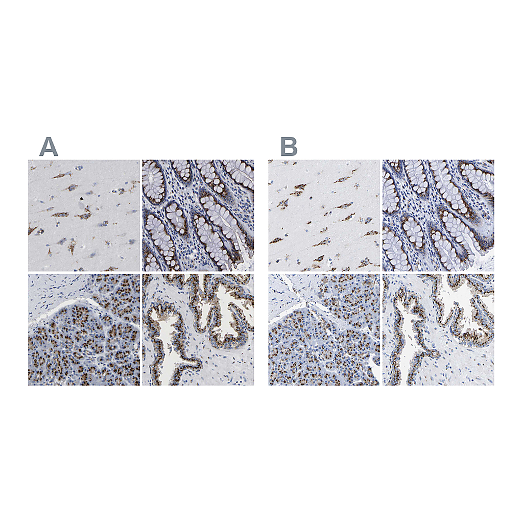 Atlas Antibodies Anti-TMEM87A Antibody