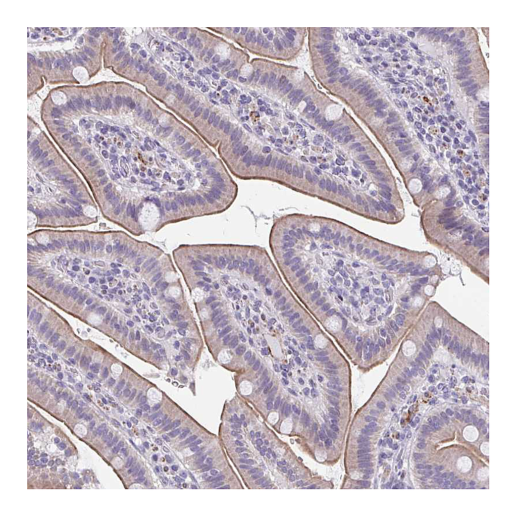 Atlas Antibodies Anti-TMEM92 Antibody