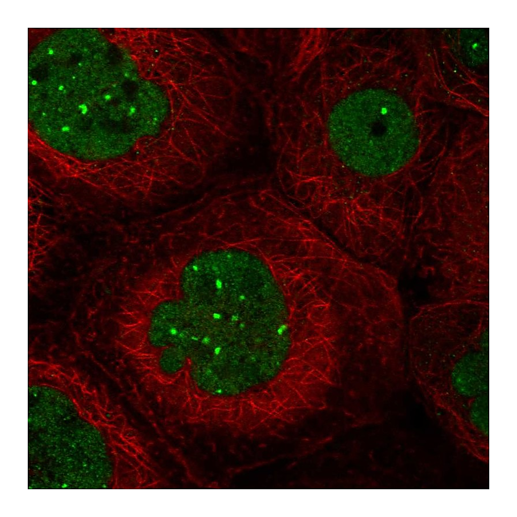 Atlas Antibodies Anti-TMEM94 Antibody