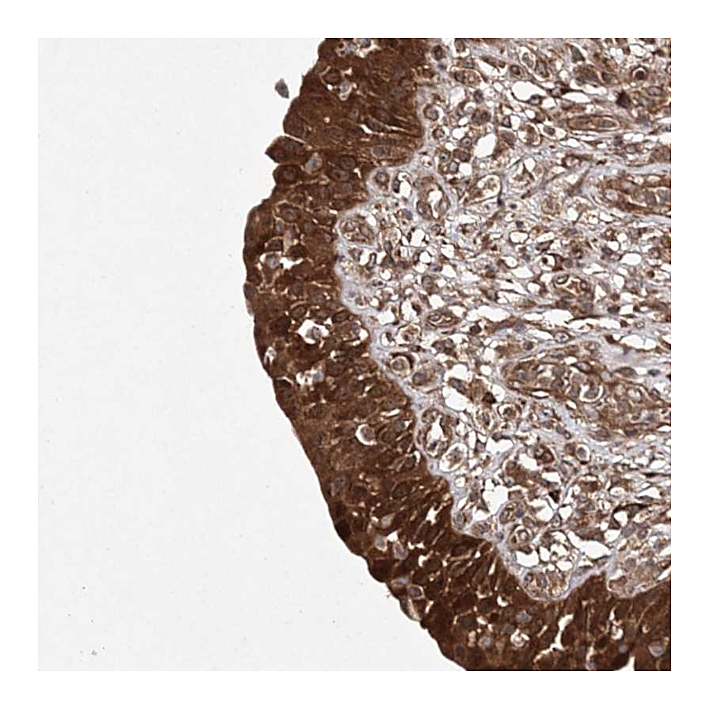 Atlas Antibodies Anti-TMEM9B Antibody