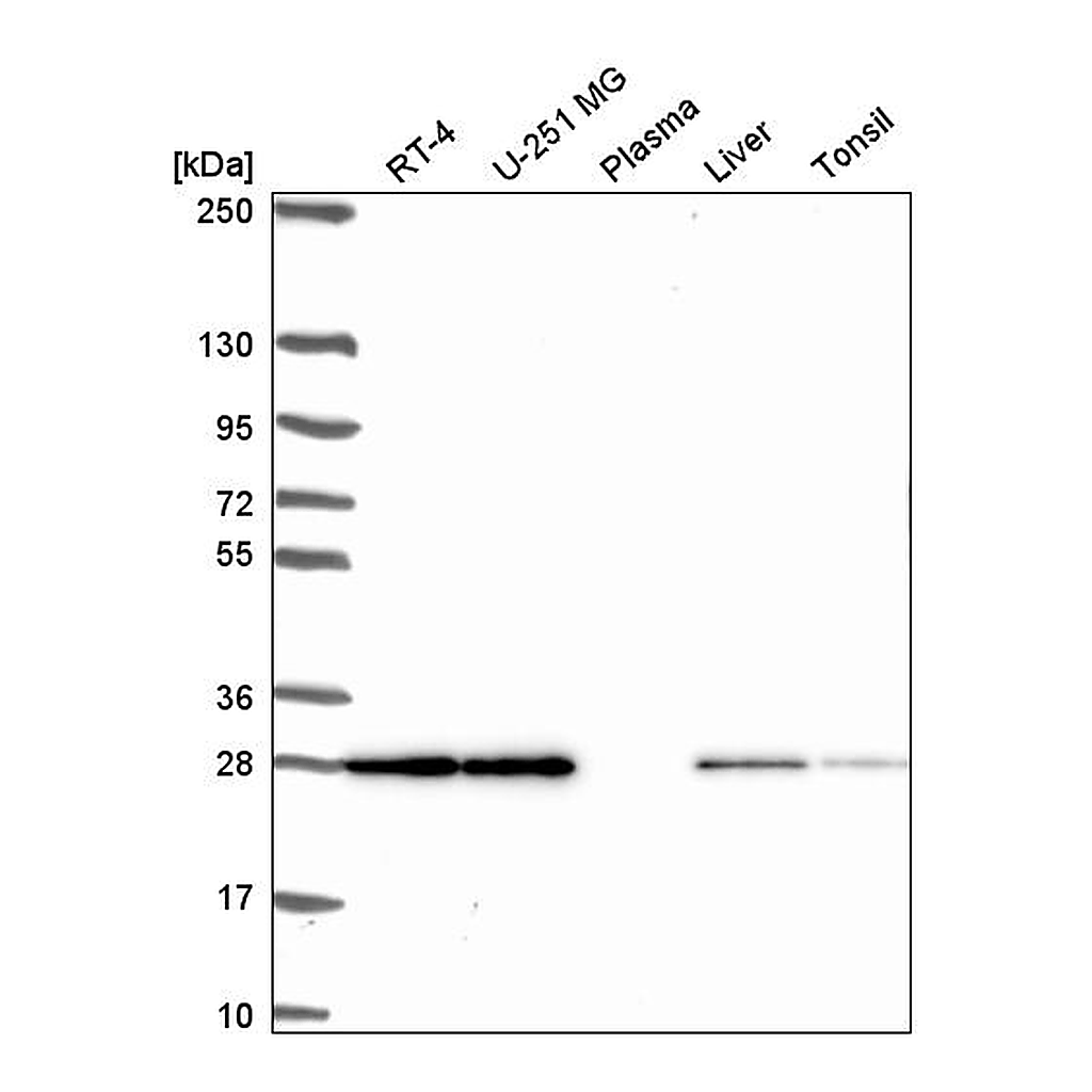 Atlas Antibodies Anti-TMEM98 Antibody
