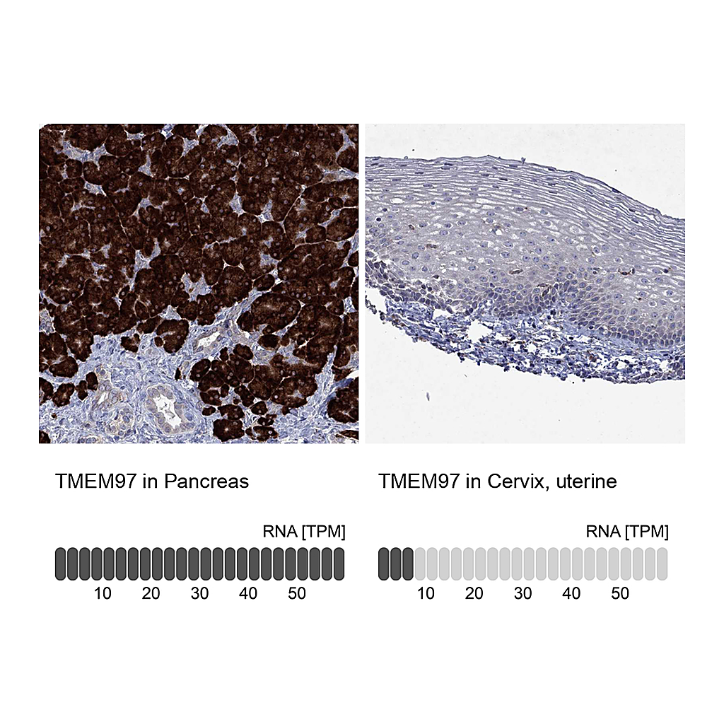 Atlas Antibodies Anti-TMEM97 Antibody