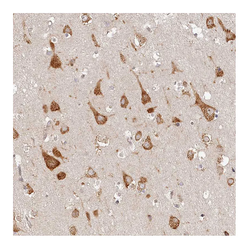 Atlas Antibodies Anti-TMIE Antibody