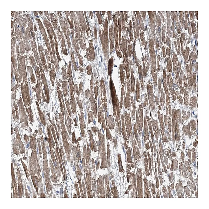 Atlas Antibodies Anti-TMLHE Antibody