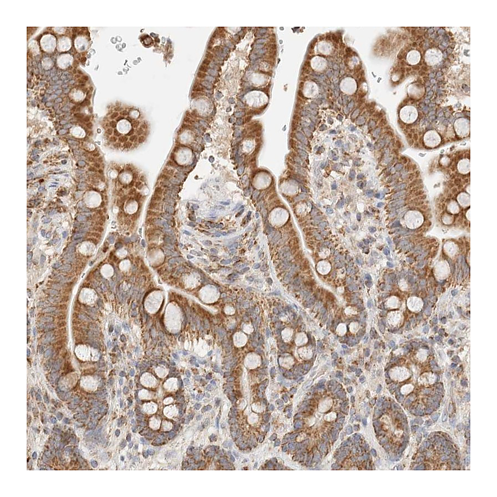 Atlas Antibodies Anti-TMPPE Antibody