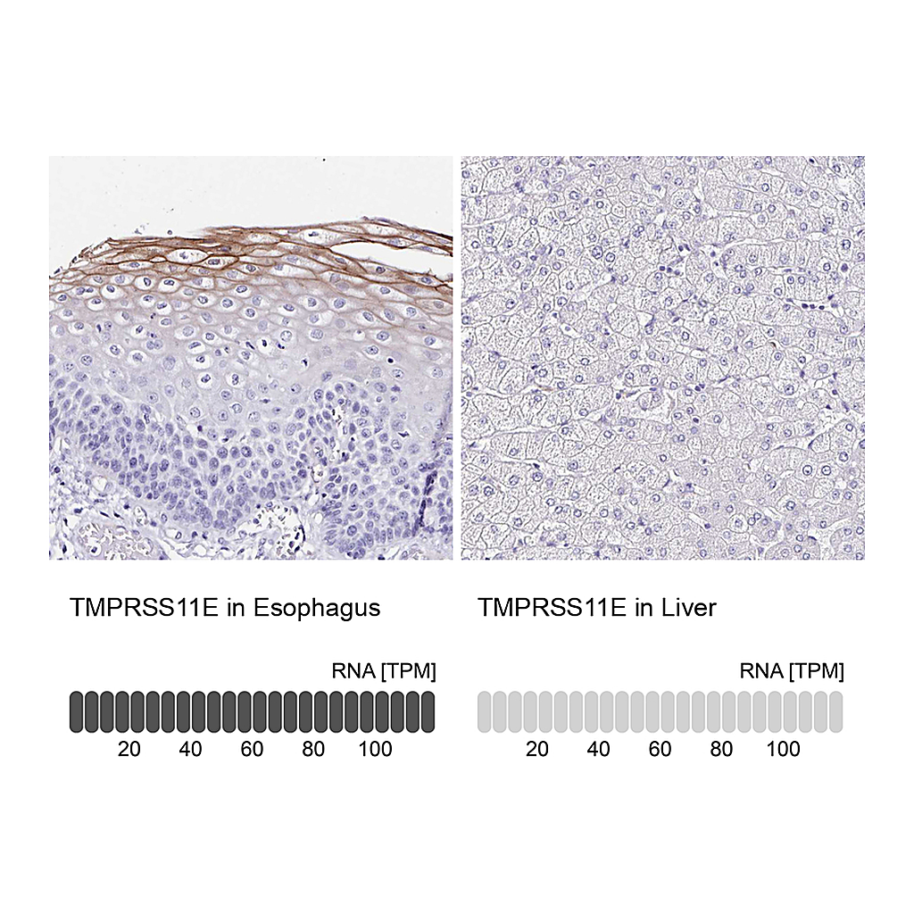 Atlas Antibodies Anti-TMPRSS11E Antibody