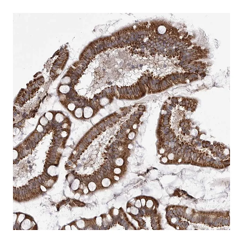Atlas Antibodies Anti-TMPRSS11F Antibody