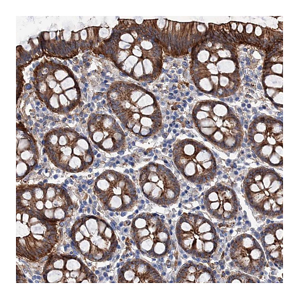 Atlas Antibodies Anti-TMTC3 Antibody