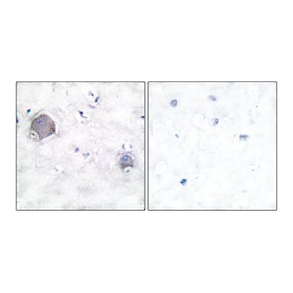 Merck ANTI-NOTCH 1 (CLEAVED-VAL1754)