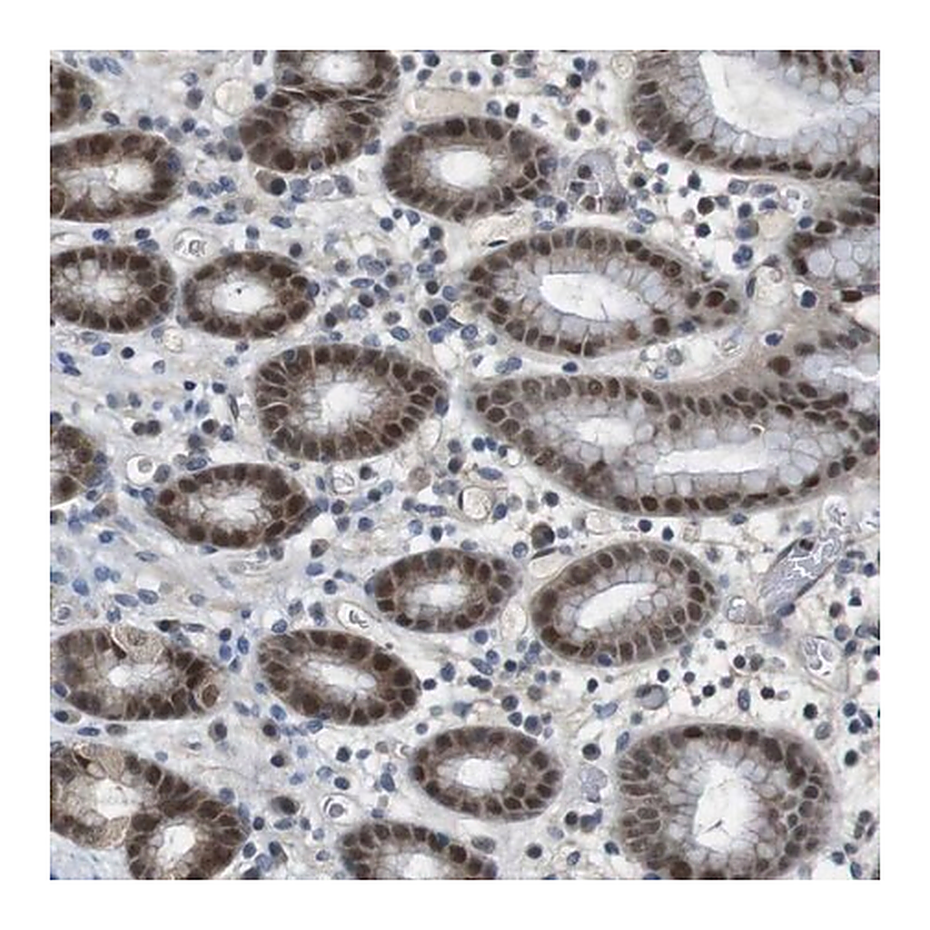 Merck Anti-MAPKAPK5 antibody produced in rabbit