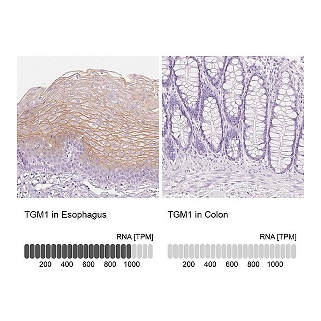 Merck Anti-TGM1 antibody produced in rabbit